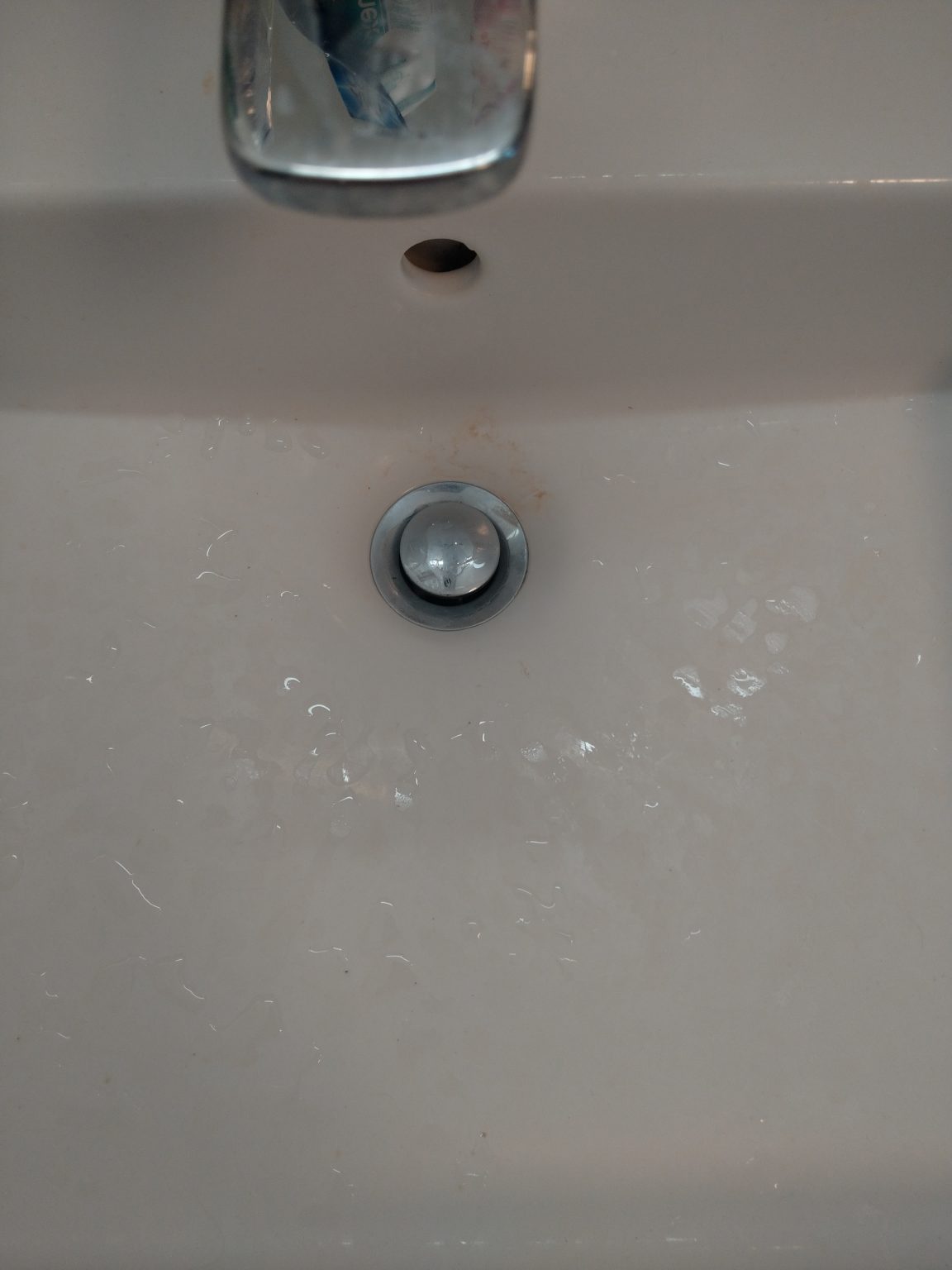 Lavabo Reinigung Vorher